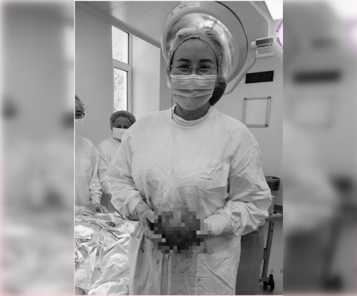 Уфимские врачи сохранили беременность женщины с килограммовой опухолью
