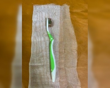 В Башкирии врачи извлекли зубную щетку из желудка пациентки