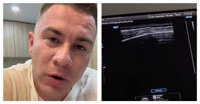 Сломавший руку блогер из Уфы Рустам Набиев сообщил о новом переломе ребра