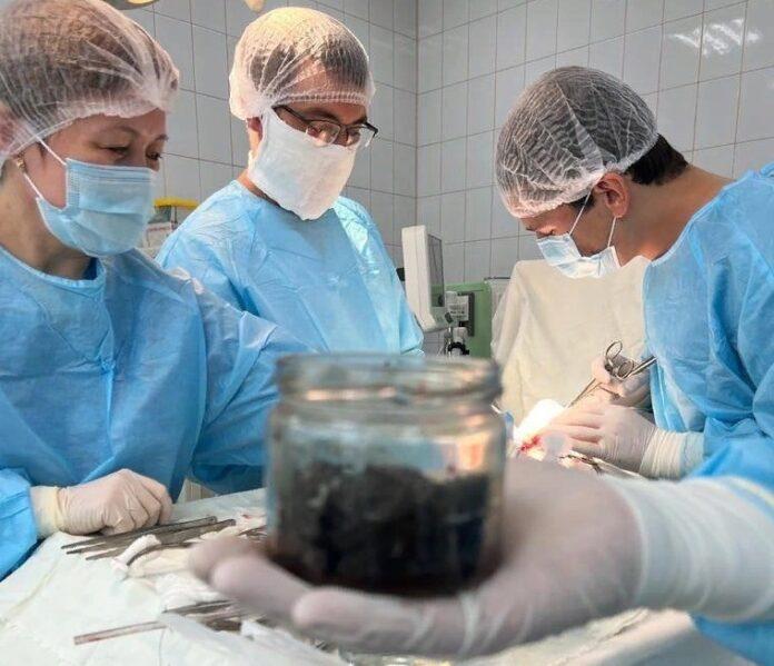 В Башкирии извлекли 300 гр магнита из желудка пациента, занимавшегося самолечением по интернету