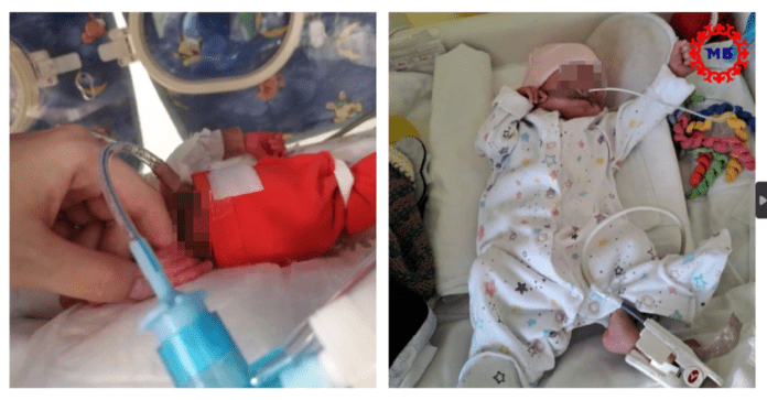 В Башкирии врачи дважды спасли жизнь новорожденной весом 900 граммов