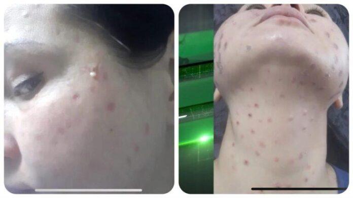 Следком проверит косметолога из Уфы, которая травмировала лицо клиентки